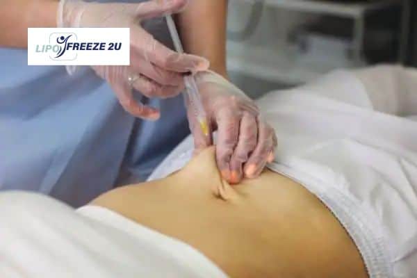 How Does Aqualyx Fat Dissolving Injection Work to Break Down Fat Bedford?