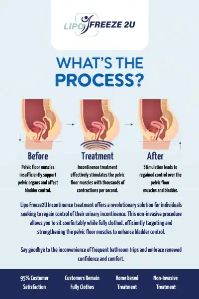 Diagram of how incontinence treatment Bedford works.