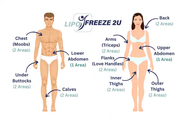 Areas you can have fat freezing treatment Bedford