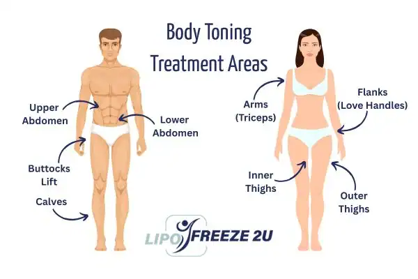 Graphic showing where you can have Body toning Treatment Bedford on your body