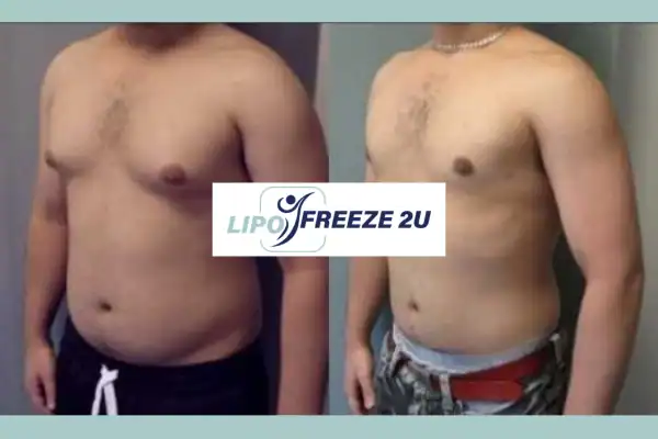 How Long Does It Take to See Results Bedford?