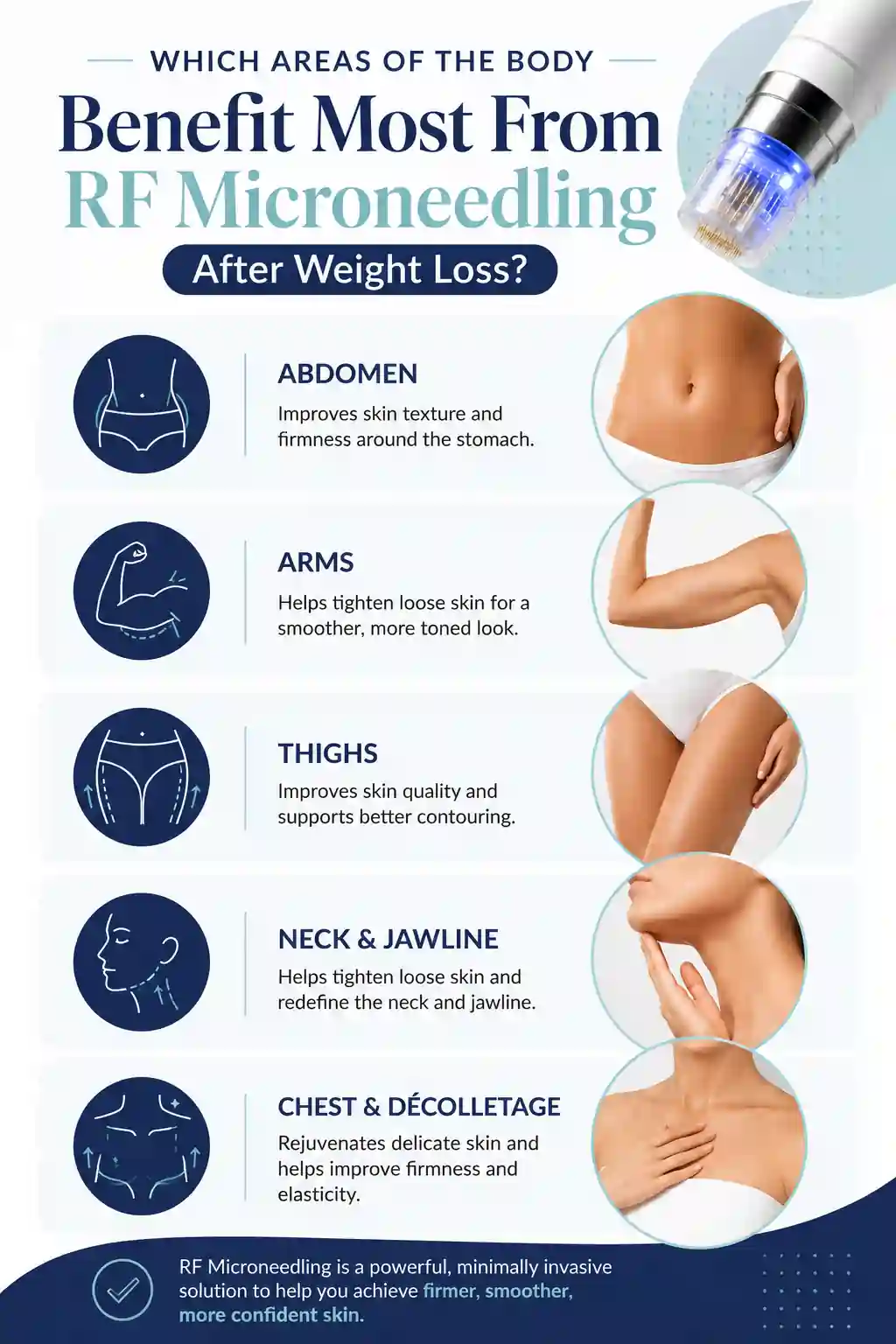 Which Areas of the Body Benefit Most From RF Microneedling After Weight Loss Bedford